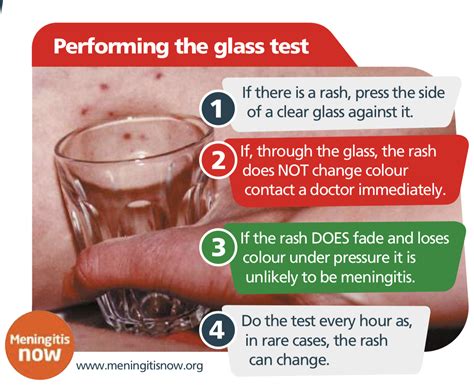 meningitis rash glass test